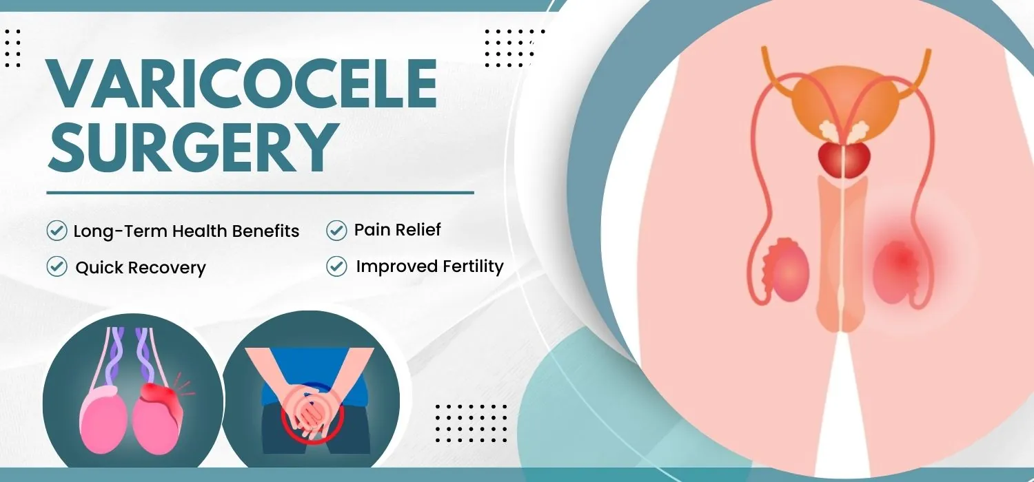 Varicocele Surgery