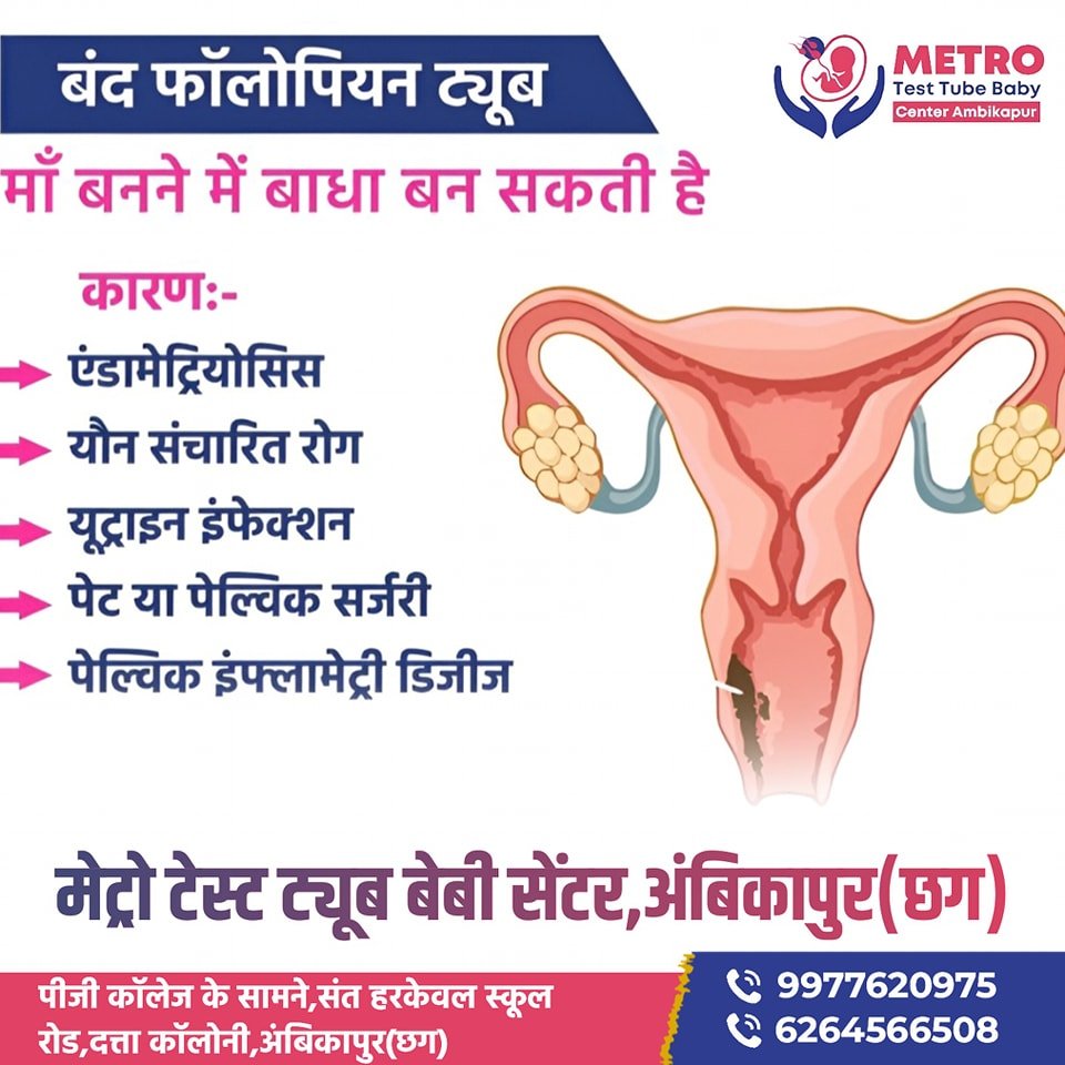 IVF Important Tips | Metro IVF Ambikapur