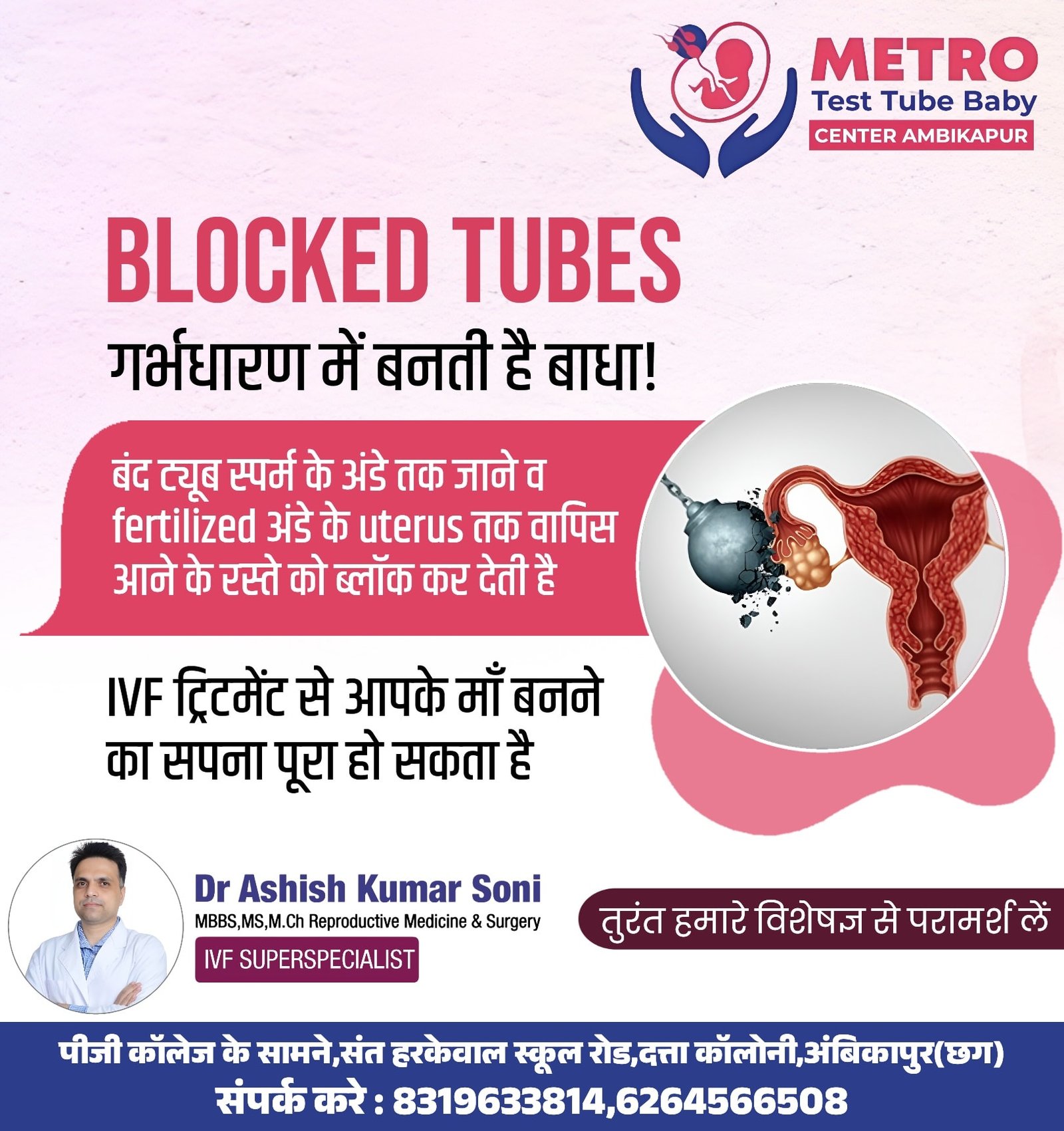 IVF Important Tips | Metro IVF Ambikapur